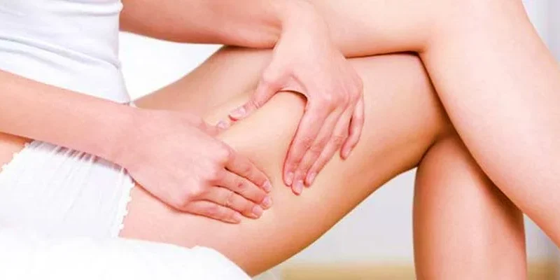 Celulite no Verão: Como Se Sentir Bem e Confiar em Si Mesma