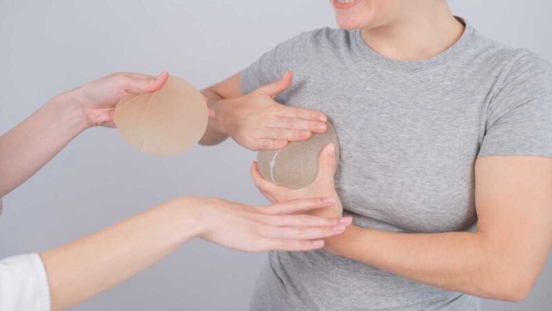 É verdade que prótese de silicone precisa ser trocada a cada 10 anos?